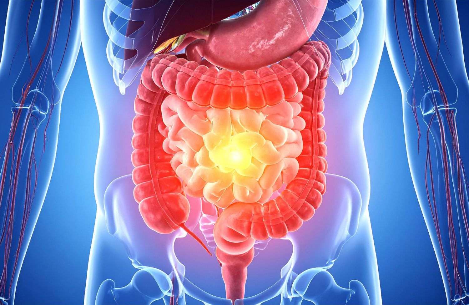 You are currently viewing GI Perforation (Hole in Intestine): Causes, Symptoms & Surgical Treatment