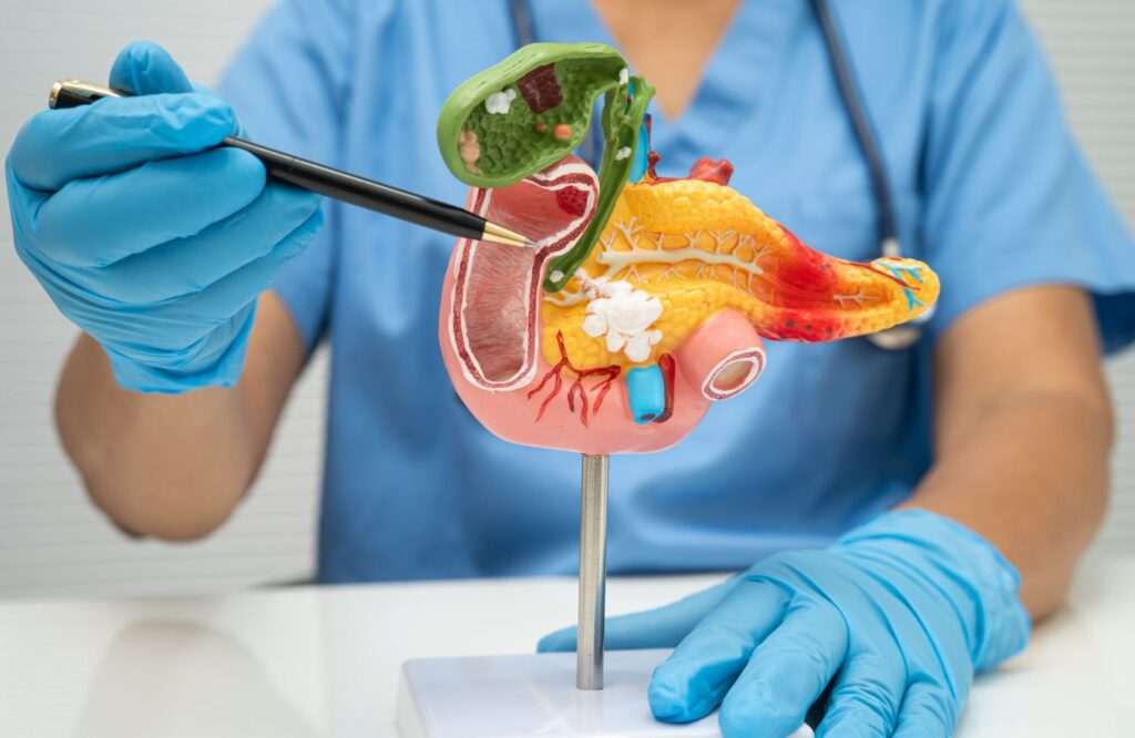 Gastrointestinal cancer