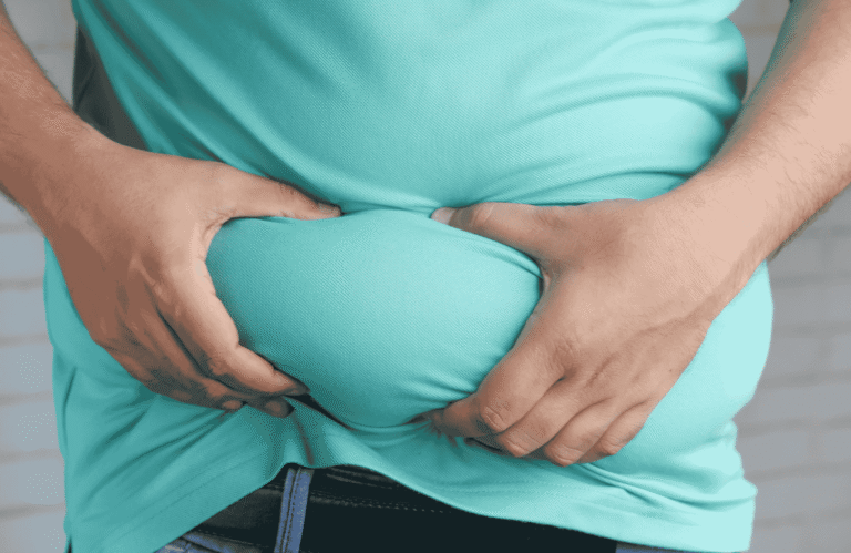 What Is the Connection Between Obesity and Hernia?