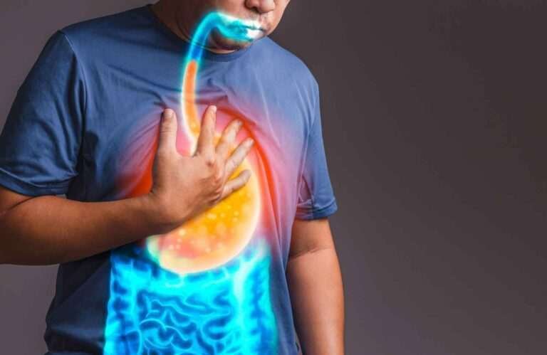 7 Warning Signs Your Acidity May Be GERD